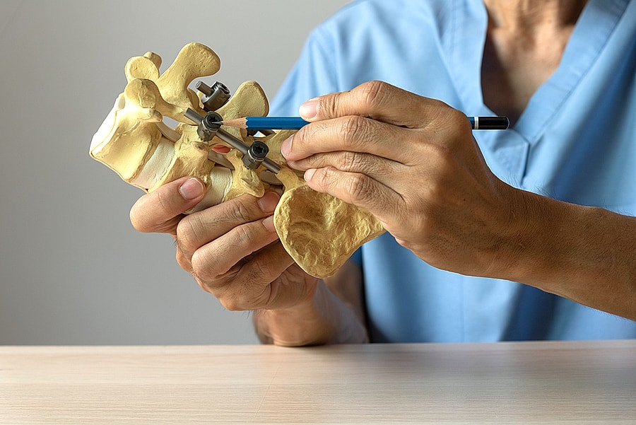 Exploring Spine Fusion Surgery: Factors to Consider