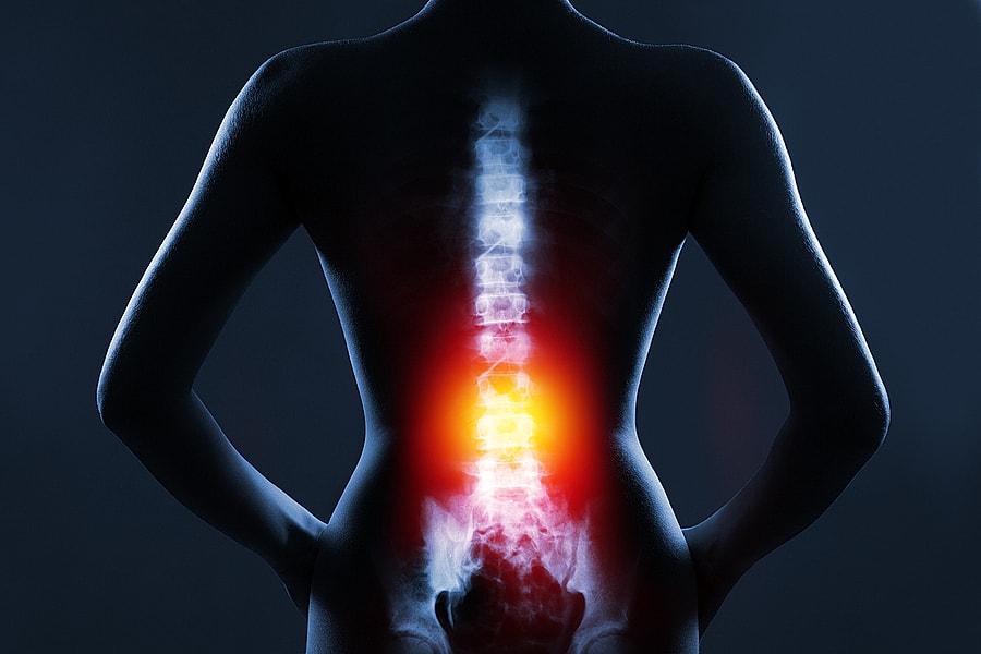 Spinal Decompression Surgery – Is It the Right Choice for You?